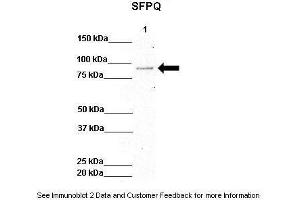 Western Blotting (WB) image for anti-Splicing Factor Proline/glutamine-Ric (SFPQ) (N-Term) antibody (ABIN2778925)