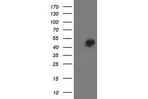Western Blotting (WB) image for anti-Spermine Synthase, SMS (SMS) antibody (ABIN1501094) (SMS antibody)