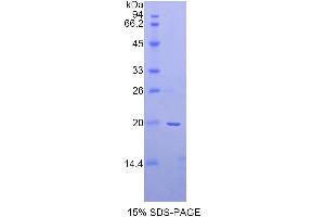 SDS-PAGE analysis of Rat a2PI Protein. (alpha 2 Antiplasmin Protein)