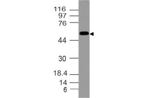 Image no. 1 for anti-Aldehyde Dehydrogenase 1 Family, Member A1 (ALDH1A1) (AA 284-492) antibody (ABIN5027017) (ALDH1A1 antibody  (AA 284-492))