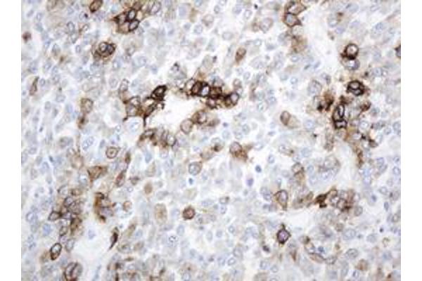 ABCB1 antibody  (AA 995-1280)