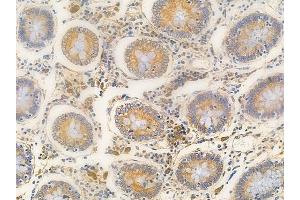 anti-NADH Dehydrogenase (Ubiquinone) 1, Subcomplex Unknown, 2, 14.5kDa (NDUFC2) (C-Term) antibody