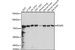 Western blot analysis of extracts of various cell lines, using FOXP2 antibody (ABIN6127914, ABIN6140762, ABIN6140763 and ABIN6221330) at 1:1000 dilution. (FOXP2 antibody  (AA 441-740))