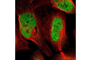 Immunofluorescent staining of U-2 OS with ARID1A polyclonal antibody  (Green) shows positivity in nucleus but excluded from the nucleoli. (ARID1A antibody)