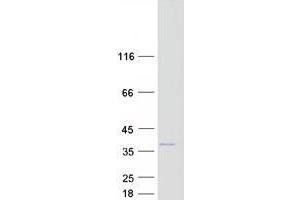 Validation with Western Blot (ZCRB1 Protein (Myc-DYKDDDDK Tag))