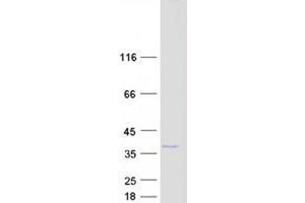 ZCRB1 Protein (Myc-DYKDDDDK Tag)