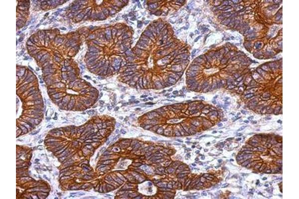Keratin 72 antibody  (AA 217-434)
