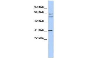 SIGLEC10 antibody used at 1 ug/ml to detect target protein. (SIGLEC10 antibody  (Middle Region))