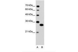 Image no. 1 for anti-Transcription Factor EC (TFEC) (AA 71-120) antibody (ABIN6736324) (TFEC antibody  (AA 71-120))