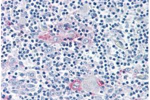 Anti-ROR Gamma antibody  ABIN1049300 IHC staining of human thymus. (RORC antibody  (Ligand Binding Domain))