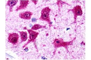 Brain, Neurons and glia (Metabotropic Glutamate Receptor 4 antibody  (C-Term))