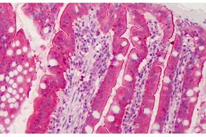 Human Small Intestine: Formalin-Fixed, Paraffin-Embedded (FFPE) (CTRP6 antibody  (C-Term))