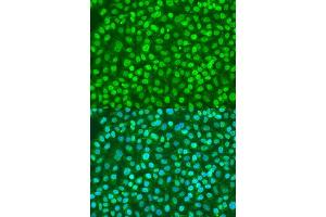 Immunofluorescence analysis of U2OS cells using BDNF antibody. (BDNF antibody  (AA 20-247))
