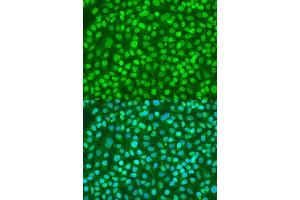 Immunofluorescence analysis of U2OS cells using BDNF antibody. (BDNF antibody  (AA 20-247))