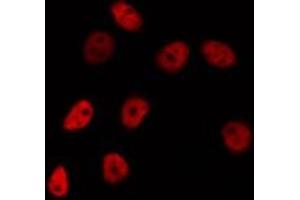 ABIN6275739 staining HepG2 by IF/ICC. (FEV antibody  (N-Term))