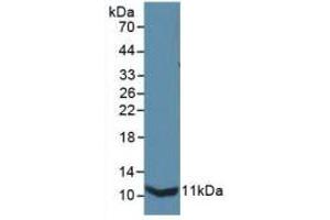 Western blot analysis of recombinant Mouse IL13Ra2. (IL13RA2 antibody  (AA 228-338))