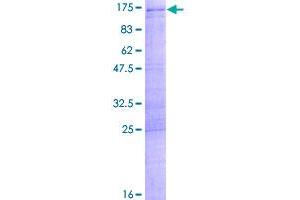 SART1 Protein (AA 1-800) (GST tag)