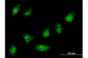 Immunofluorescence of purified MaxPab antibody to ZNF576 on HeLa cell.