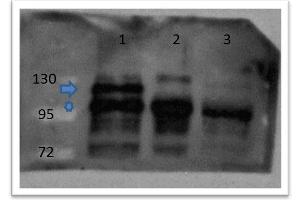 Western Blot of Rabbit anti-catenin ß-1 antibody Lane 1: zebrafish embryos injected with myc tagged catenin ß 1 mRNA Lane 2: zebrafish embryos injected with myc tagged catenin ß 2 mRNA Lane 3: zebrafish embryos un-injected Primary antibody: catenin ß-1 antibody at 1:500 overnight at 4°C Secondary antibody: goat anti-rabbit HRP at 1:10,000 for 1 hour at RT Predicted/Observed size: 85. (beta Catenin antibody  (C-Term))