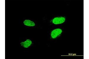 Immunofluorescence of monoclonal antibody to ATF2 on HeLa cell. (ATF2 antibody  (AA 1-209))