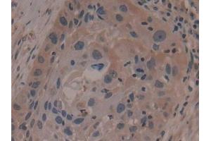 Immunohistochemistry (IHC) image for anti-Anoctamin 6 (ANO6) (AA 744-824) antibody (ABIN7436141)