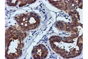 Immunohistochemical staining of paraffin-embedded Human breast tissue using anti-FGFR2 mouse monoclonal antibody. (FGFR2 antibody)