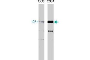 Rbl1 monoclonal antibody, clone KAB6  recognizes both the phosphorylated and unphosphorylated forms of p107 at 107kDa. (p107 antibody)