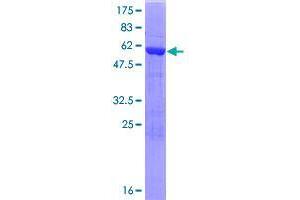 Chromosome 21 Open Reading Frame 59 (C21orf59) (AA 1-290) protein (GST tag)