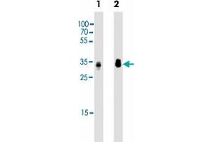 Western blot analysis of Lane 1: Hela whole cell lysates Lane 2: HepG2 whole cell lysates reacted with PPT1 monoclonal antibody  at 1:2000 dilution. (PPT1 antibody)