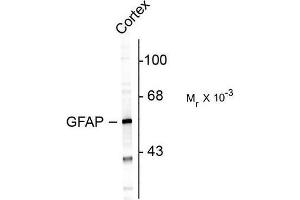 Image no. 1 for anti-Glial Fibrillary Acidic Protein (GFAP) antibody (ABIN372651)