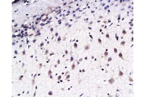 Immunohistochemistry (Paraffin-embedded Sections) (IHC (p)) image for anti-EPH Receptor B2 (EPHB2) (AA 551-650) antibody (ABIN730708) (EPH Receptor B2 antibody  (AA 551-650))