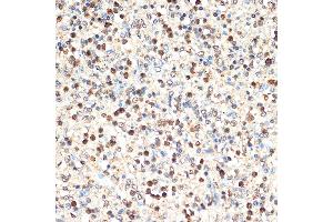 Immunohistochemistry of paraffin-embedded human spleen using SHIP11 Rabbit mAb (ABIN7267882) at dilution of 1:100 (40x lens). (INPP5D antibody)