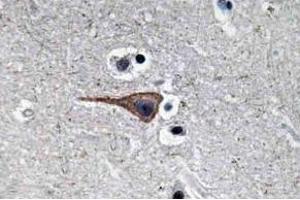 Immunohistochemistry (IHC) analysis of EGF antibody in paraffin-embedded human brain tissue.