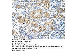 Rabbit Anti-MIF4GD Antibody  Paraffin Embedded Tissue: Human Kidney Cellular Data: Epithelial cells of renal tubule Antibody Concentration: 4. (MIF4GD antibody  (C-Term))