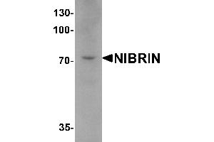 Western blot analysis of NIBRIN in mouse lung tissue lysate with NIBRIN antibody at 1 µg/mL. (Nibrin antibody  (C-Term))