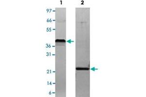 Lane 1: non-reducing conditions Lane 2: reducing conditions (VEGFA Protein)