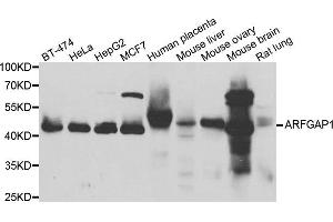 Western blot analysis of extracts of various cell lines, using ARFGAP1 antibody. (ARFGAP1 antibody)
