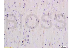 Formalin-fixed and mouse heart tissue labeled with Anti-SOD2 Polyclonal Antibody, Unconjugated (ABIN737361) at 1:200 followed by conjugation to the secondary antibody and DAB staining (SOD2 antibody  (AA 41-78))