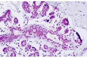 Human, Breast: Formalin-Fixed Paraffin-Embedded (FFPE) (ZMYND8 antibody  (AA 581-630))