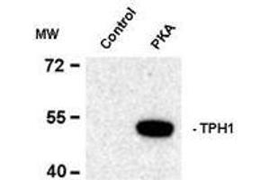 Image no. 1 for anti-Tryptophan Hydroxylase 1 (TPH1) (pSer58) antibody (ABIN372732) (Tryptophan Hydroxylase 1 antibody  (pSer58))