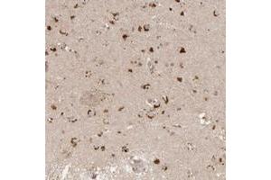Immunohistochemical staining of human lateral ventricle with FAM211A polyclonal antibody  shows strong cytoplasmic positivity in neuronal cells at 1:20-1:50 dilution. (LRRC75A/FAM211A antibody)