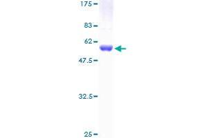 IKBKB Protein (AA 1-256) (GST tag)