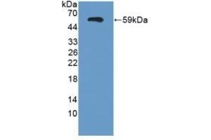 Detection of Recombinant SEMA3E, Human using Polyclonal Antibody to Semaphorin 3E (SEMA3E) (SEMA3E antibody  (AA 32-516))