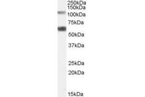 OGT antibody  (Internal Region)