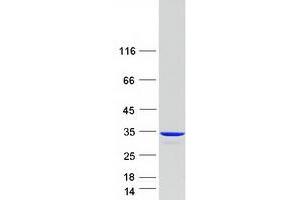 Validation with Western Blot (CLIC2 Protein (Myc-DYKDDDDK Tag))