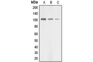 Western blot analysis of AASS expression in HUVEC (A), HeLa (B), HEK293T (C) whole cell lysates. (AASS antibody  (Center))