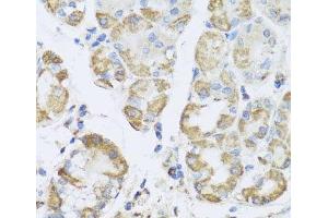 Immunohistochemistry of paraffin-embedded Human stomach using PRKAG1 Polyclonal Antibody at dilution of 1:100 (40x lens). (PRKAG1 antibody)