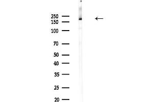Western blot analysis of lysates from PC12 cells(heat-shock,45 min treatment), using Clathrin Antibody at 1/1000 dilution. (Clathrin antibody  (C-Term))