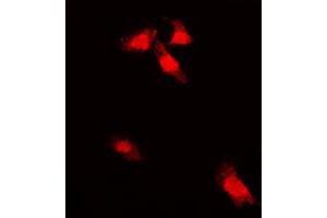 Immunofluorescent analysis of G3BP1 (pS232) staining in A549 cells. (G3BP1 antibody  (pSer232))