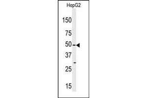 Image no. 1 for anti-Mitogen-Activated Protein Kinase Kinase Kinase MLT (ZAK) (Middle Region) antibody (ABIN360531)